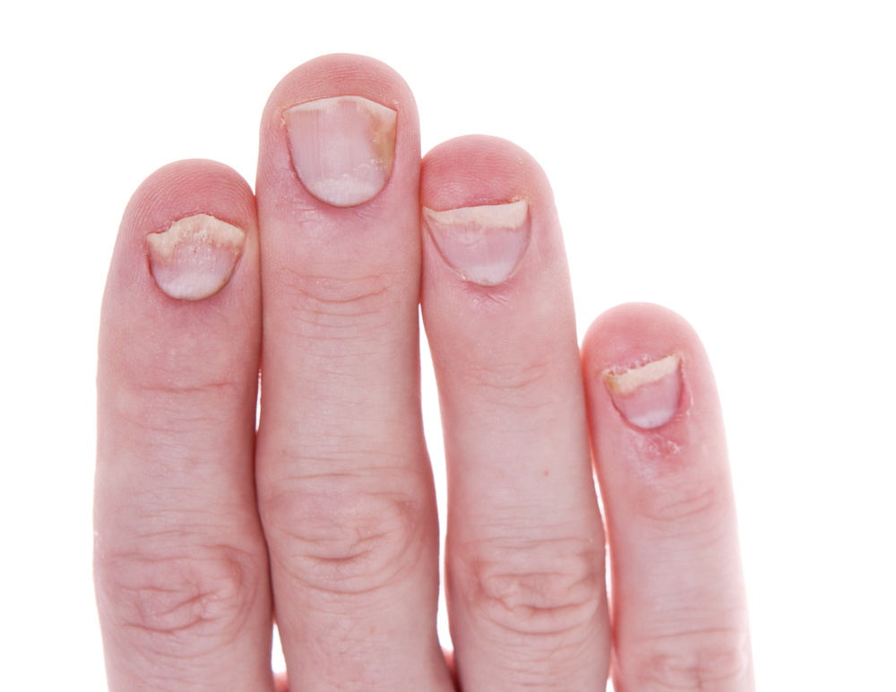 What Are Your Nails Saying About Your Health? Find Out Now!