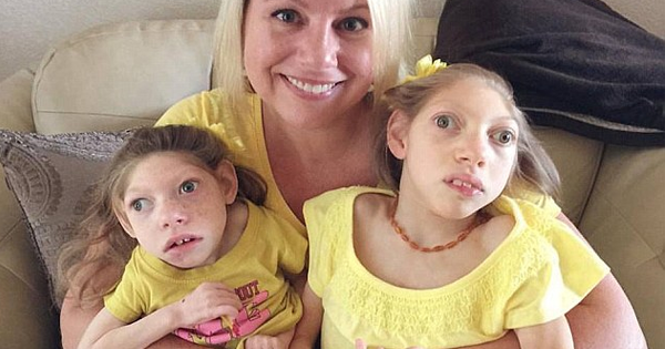 These Two Sisters Are Five Feet Tall And 42 Pounds...COMBINED. Their Mother Says It