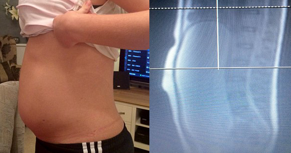 Doctor Suspects Teen Is Hiding Pregnancy When He Sees Her Belly—Until He Checks Her Scan...