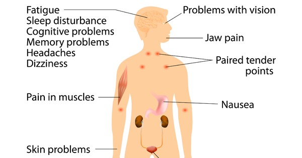 Warning Signs Of Fibromyalgia You Should Never Ignore