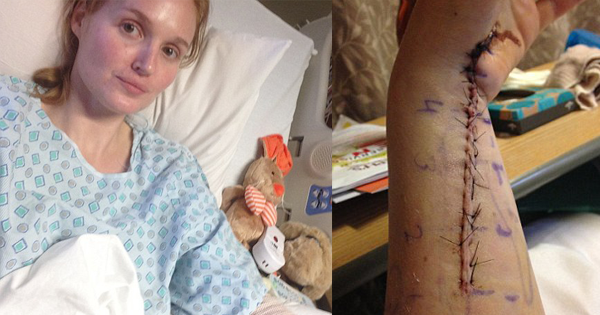 Woman Nearly Loses HER ARM After A Tiny Bruise Turns Out To Be...