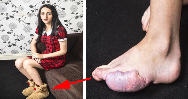 Her Foot Surgery Goes Wrong, And Now She Can No Longer Walk..