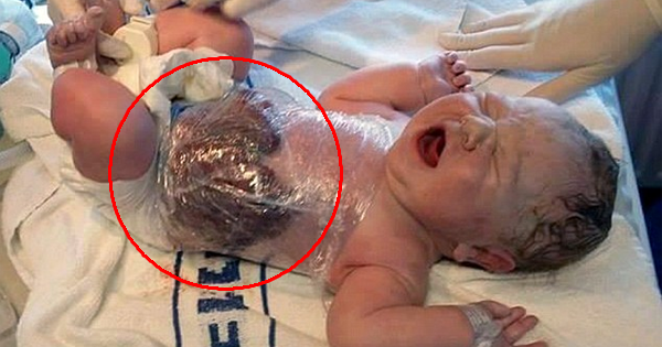 OMG! He Is Born With His Stomach OUTSIDE His Body!