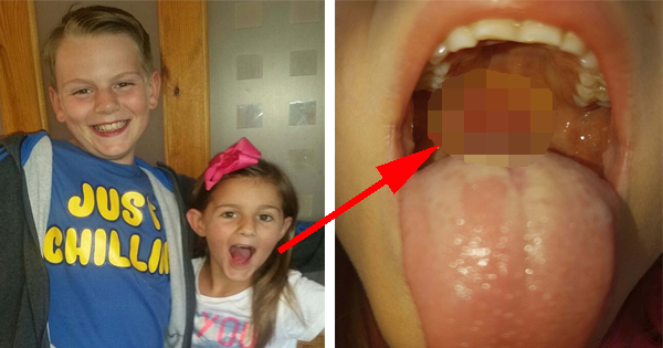 Her Brother Notices Something Strange In Her Throat During A Tickle Fight And Ends Up Saving Her Life