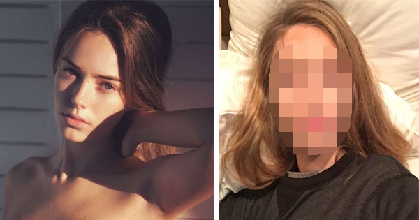 She Shares A Terrifying Photo Of Herself To Remind Women To Always Wash Their Makeup Brushes