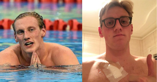 Olympic Swimmer Has His Life Saved By A Fan Who Identifies His Cancer