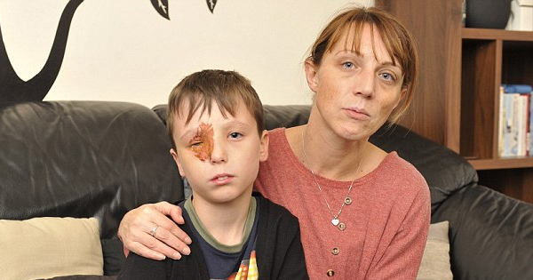 Boy Goes To A Local Firework Show, When All Of A Sudden, The Display Falls And A Rocket Fires In His Face