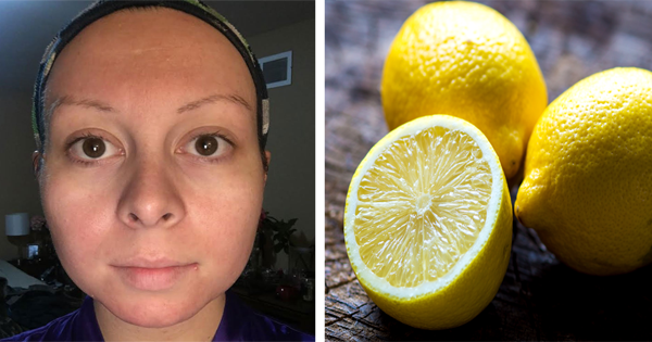 She Uses A Lemon To Clean Her Skin And Her Complexion Improves Dramatically