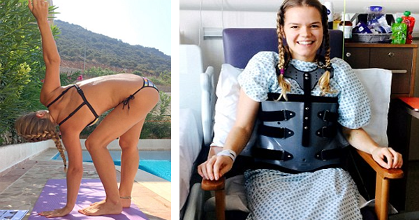 Doctors Are Amazed When She Walks Just 11 Days After Getting Hit By A Car Thanks To Her Hyper-Flexible Spine.