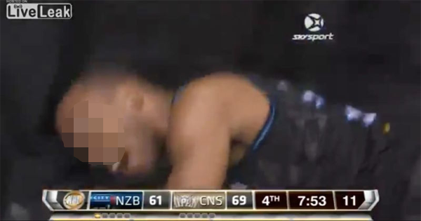 Watch A Pro Basketball Player Gets His Eyeball Popped Out Of Its Socket