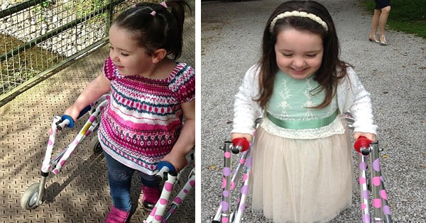 This Little Girl Falls Up To 15 Times A Day, But Her Doctors Can