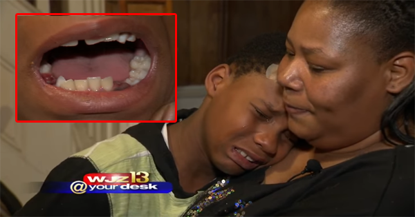 She Sends Her Son To School One Day, Only To Have Him Return Home After Having Three Teeth Extracted.