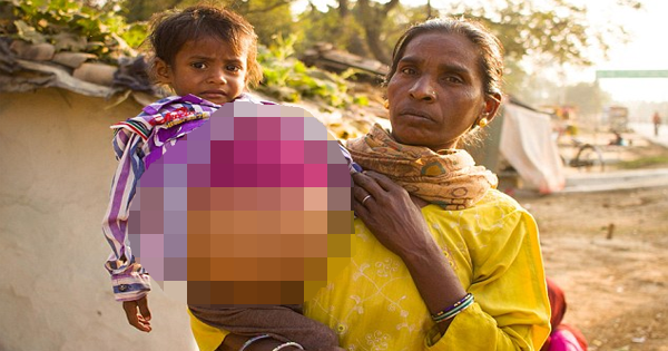 This 3-Year-Old Girl Has A Cancerous Tumor So Large, Her Stomach Has Swollen To The Size Of A Beach Ball