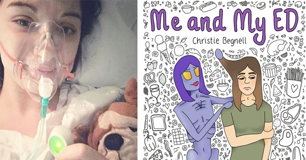 She Goes From Eating Just 300 Calories Each Day To Conquering Her Eating Disorder By Drawing.