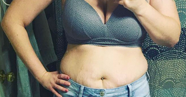 She Posts A Photo To Show What A Postpartum Body Looks Like, Then Reveals What Happened To Her Baby.