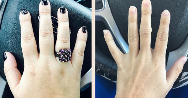 She Takes Two Photos Of Her Hands. When She Realizes What The Dramatic Transformation Is, She