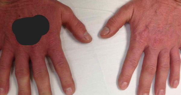 A Doctor Posts This Photo To See If People Can Spot A Very Rare Condition Of This Person.