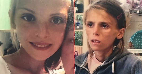 After Struggling To Fight Anorexia, This Teen Ends Her Life. But Others Think Doctors Could