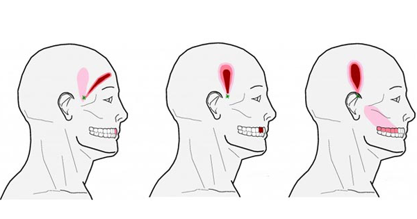 Forget Pain Pills: These Powerful Pressure Points Will Relieve Even Your WORST Headache!